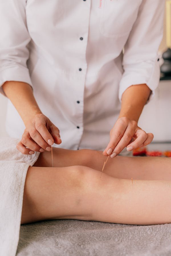 Découvrez les bienfaits de l'acupuncture à marseille